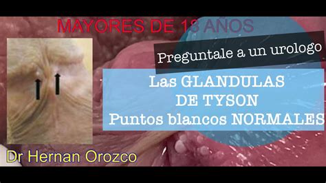 glandula de tyson|Las glándulas de Tyson: todo lo que debes saber。